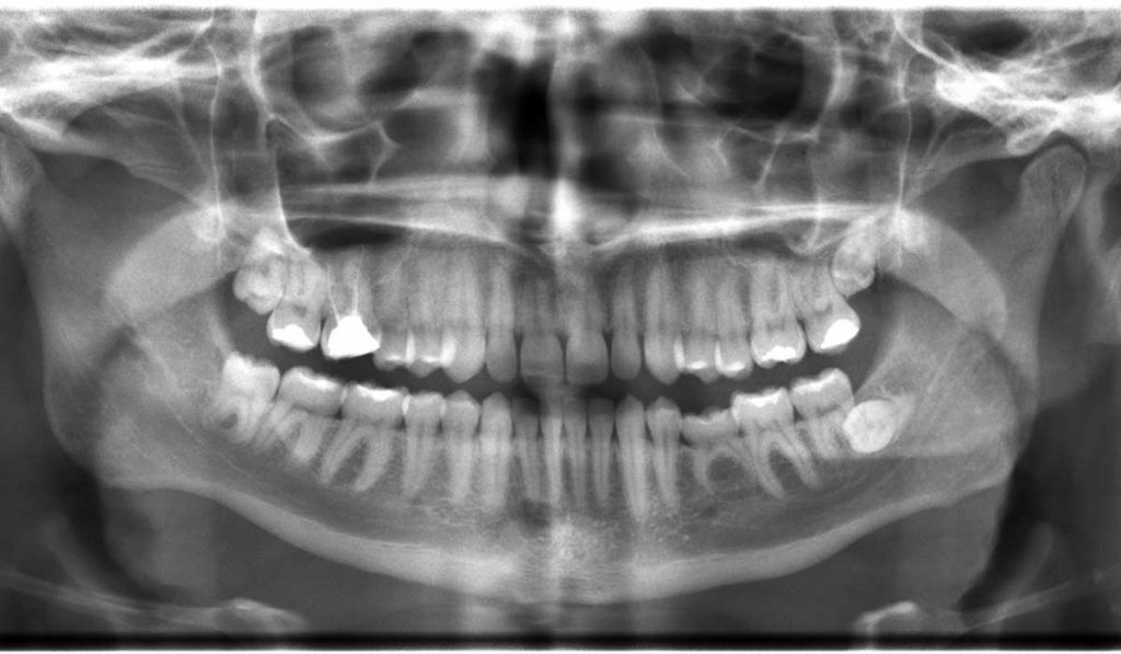 dental-xray-while-pregnant - Elko Dental Specialists » Elko Dental ...